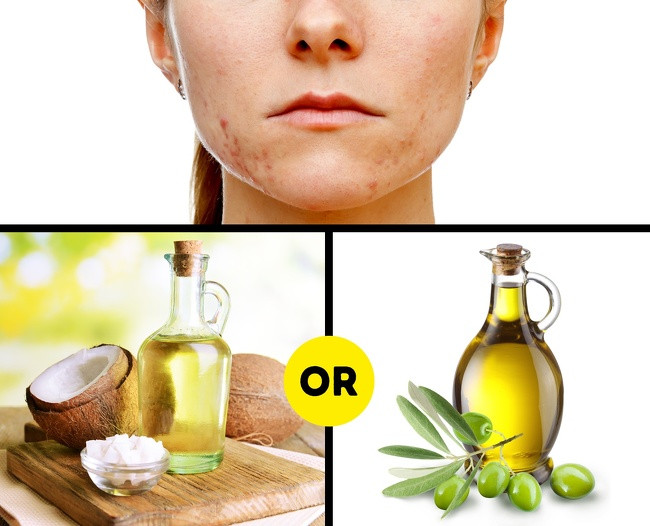 Massage vết sẹo bằng dầu ô liu hoặc dầu dừa trong 5-10 phút vài lần một ngày cho đến khi đạt được kết quả mong muốn.