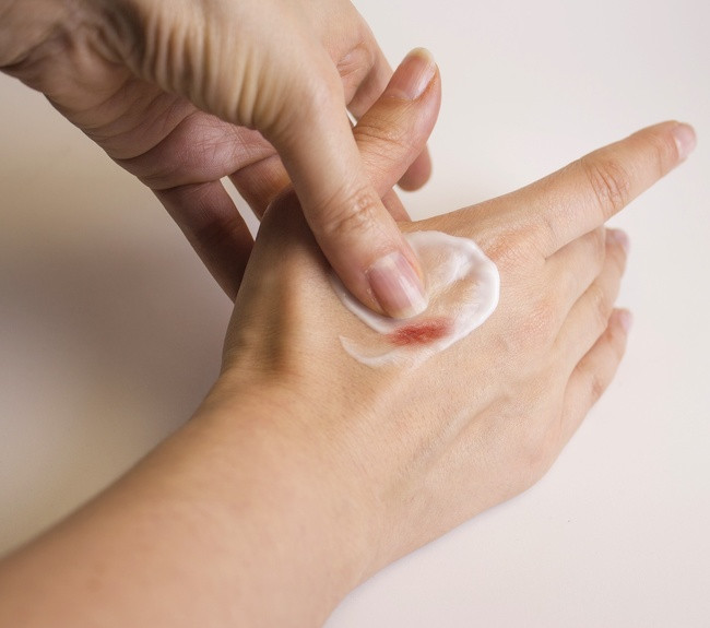 Một cách làm mờ sẹo nhanh là xoa bóp vùng sẹo với kem dưỡng da. Nhẹ nhàng massage vết sẹo trong 15-30 giây vài lần mỗi ngày.