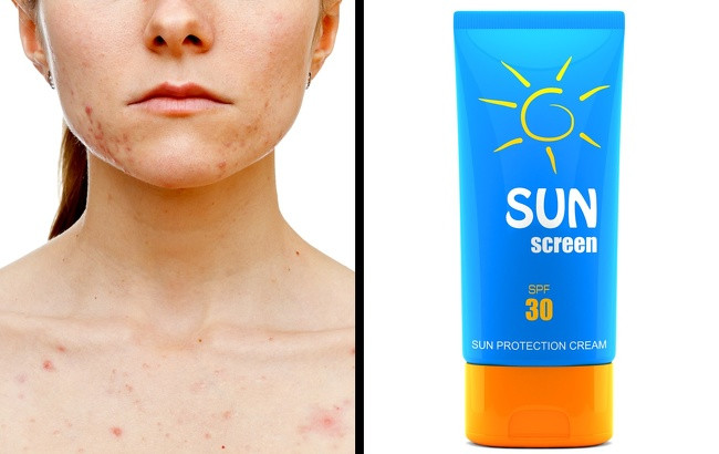 Nếu bạn muốn vết sẹo nhanh mờ, đừng bao giờ để da tiếp xúc với tia cực tím. Luôn luôn sử dụng kem chống nắng với SPF 15 hoặc cao hơn khi ra ngoài.