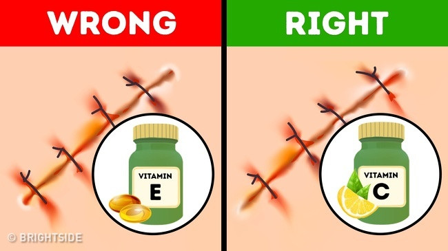 Vitamin C có thể dần làm mờ sẹo. Để thúc đẩy sự tổng hợp collagen, da của chúng ta cần bổ sung vitamin C cả đường uống và bôi kem. Ảnh: BS.