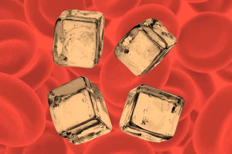 Bạn thèm đá viên và các món ăn vặt lạ khác: Một trong những triệu chứng hiếm gặp nhất của bệnh thiếu máu là bạn có xu hướng thèm các món ăn không dinh dưỡng như đá viên, baking soda, đất sét hoặc thậm chí bút chì hay sơn khô.