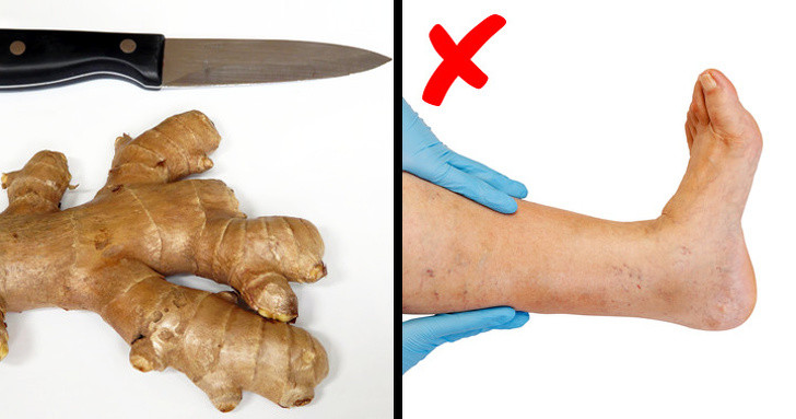 Những đồ ăn, thức uống giúp giảm tình trạng phù nề - Hình 5 Nhung do an, thuc uong giup giam tinh trang phu ne-Hinh-5