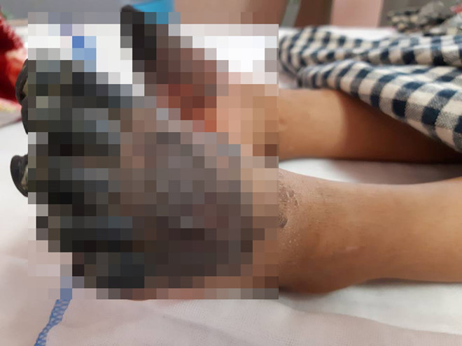 Đôi bàn chân không còn sự sống của bé Thư. Ảnh: HQ.