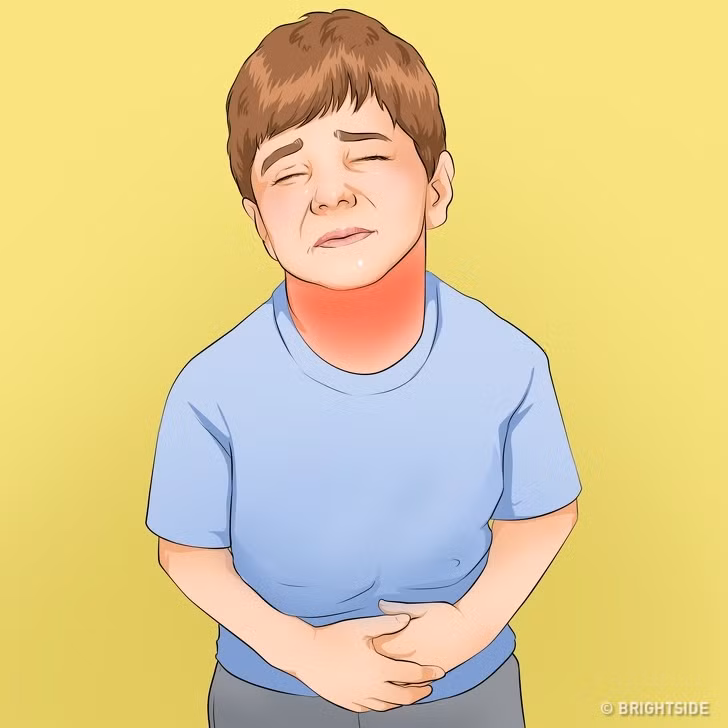 Cach nhan biet 10 benh thuong gap o tre nho-Hinh-2