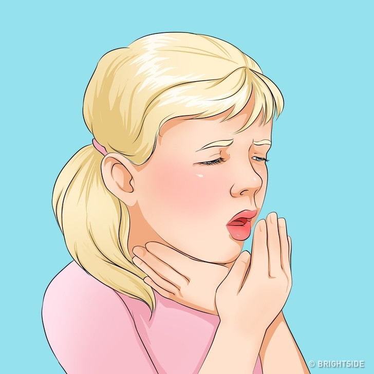 Viêm thanh khí phế quản cấp: Bệnh này thường xuất phát từ việc bị cảm lạnh thường xuyên. Sau đó trẻ sẽ bị ho khan và sưng cổ họng. Bệnh khá nguy hiểm nên bạn cần sớm đưa trẻ đi khám chữa.