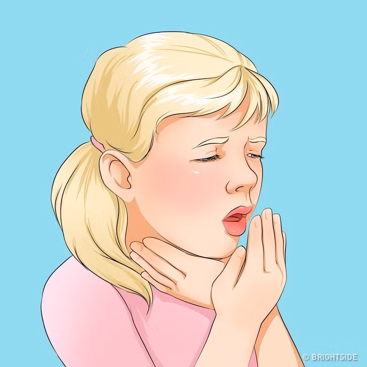 Cach nhan biet 10 benh thuong gap o tre nho-Hinh-8