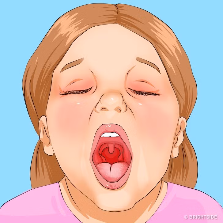 Cach nhan biet 10 benh thuong gap o tre nho