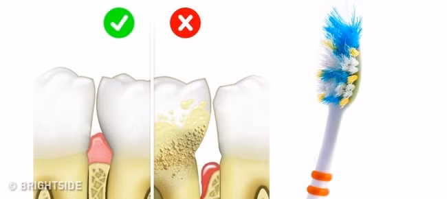 Bàn chải đánh răng có thể tích vi khuẩn trong ít nhất một tháng, nha sĩ khuyên bạn nên thay bàn chải đánh răng mỗi 2-3 tháng một lần, đánh răng đúng cách chuẩn trong hai phút.