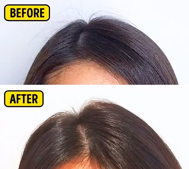 Hàn Quốc đã tạo những chiếc máy lăn nhỏ mini được quảng cáo là giúp tạo độ phồng cho những người sở hữu mái tóc mỏng.