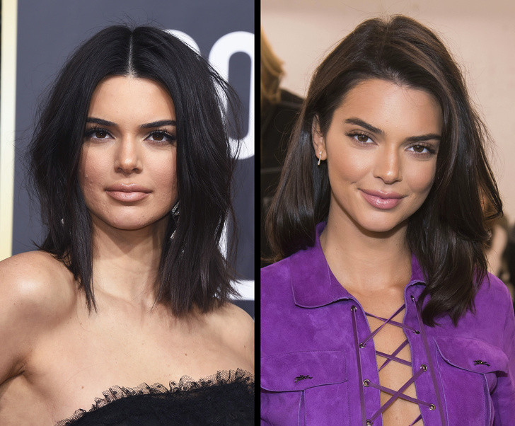 Cách trị mụn trứng cá của Kendall Jenner: Thành phần gồm 1/2 muỗng cà phê nước cốt chanh, 1/2 muỗng cà phê baking soda và 1 muỗng cà phê mật ong. Chỉ cần trộn tất cả các thành phần và áp dụng hỗn hợp lên vùng da bị mụn để qua đêm. Đây là cách trị mụn trứng cá rất đơn giản nhưng hiệu quả.