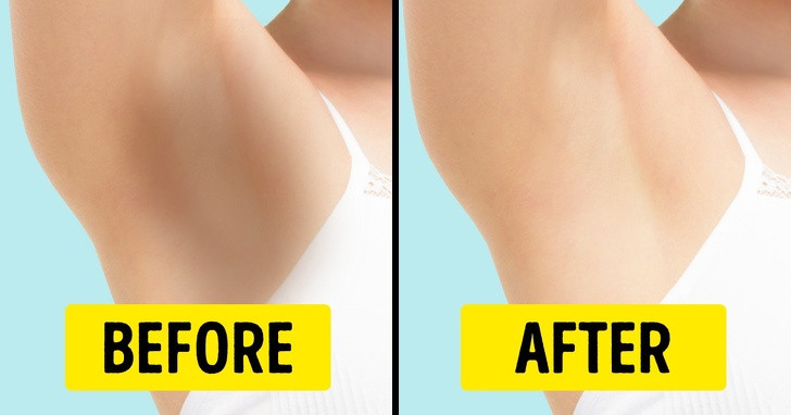 Để trị thâm ở vùng da dưới cánh tay, bạn có thể trộn 2 thìa cà phê bột nghệ, 1 thìa cà phê baking soda, 3 thìa cà phê mật ong và nửa quả chanh. Rửa sạch vùng da dưới cánh tay rồi thoa hỗn hợp lên. Chờ khoảng 20 phút cho đến khi kem khô lại rồi rửa sạch.