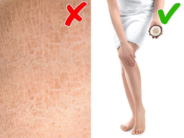 Với làn da toàn thân cũng vậy, bạn cần dưỡng ẩm để bạn trông luôn khỏe mạnh và đầy sức sống. Tránh những trường hợp lộ vết nứt nẻ hay da chết khi bạn mặc váy hay quần soóc. Nếu bạn chưa biết nên dùng loại kem dưỡng da nào thì hãy thử dầu dừa.