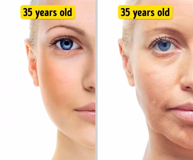 Xem tivi và các thiết bị di động nhiều cũng gây hại trực tiếp tới làn da của bạn. Hậu quả của việc này là gây lão hóa da sớm và tăng sắc tố.