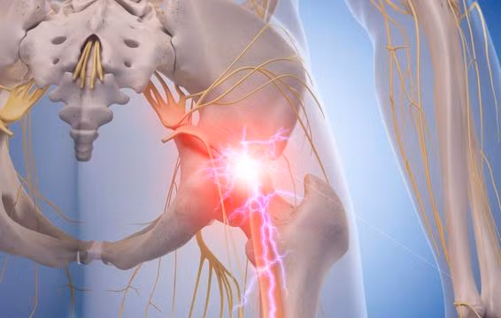 Bạn cảm thấy đau lan lọc một bên chân. Nếu bạn cảm thấy đau nhói liên tục, đau như lửa đốt hoặc ngứa ran bắt đầu từ lưng dưới và lan xuống mặt sau chân có nghĩa rằng bạn bị đau thần kinh tọa.