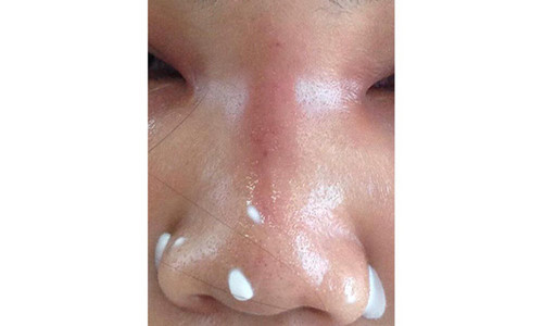 Nhan nhan quang cao nang mui gia sieu re tu 1,5 trieu dong-Hinh-3