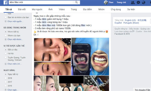 Nhan nhan quang cao nang mui gia sieu re tu 1,5 trieu dong-Hinh-2