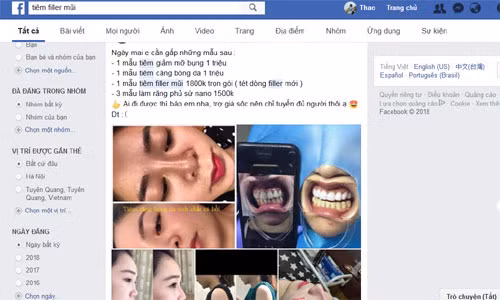 Nhan nhản quảng cáo nâng mũi giá siêu rẻ từ 1,5 triệu đồng - Hình 2 Nhan nhan quang cao nang mui gia sieu re tu 1,5 trieu dong-Hinh-2