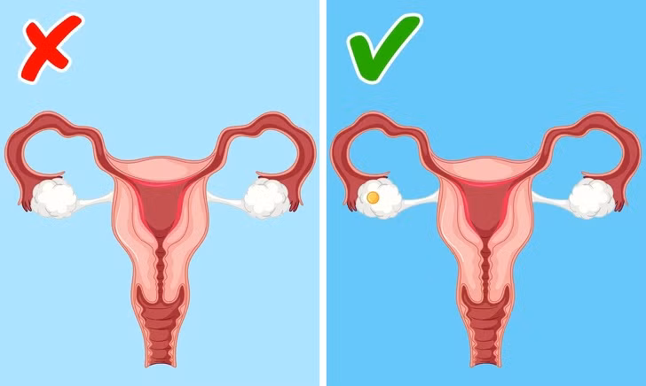 Tập luyện quá mức có thể làm gián đoạn chu kỳ kinh nguyệt. Thể dục quá mức gây mất cân bằng nội tiết tố trong cơ thể phụ nữ dẫn đến sự gián đoạn chu kỳ kinh nguyệt. Do vậy, bạn nên thể dục ở mức vừa phải.