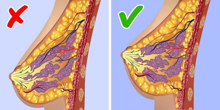 Ngực chảy có thể do thiếu nước. Thiếu nước trong cơ thể khiến da trở nên khô và nhão. Đó là lý do tại sao, để ngăn ngực bị chảy xệ, bạn phải theo dõi sự cân bằng nước của cơ thể.
