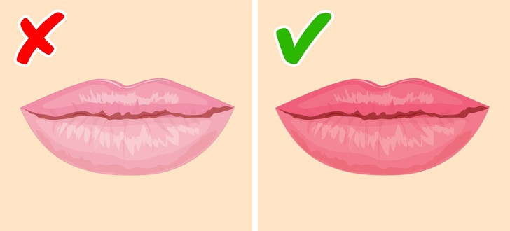 Màu môi cảnh báo tình trạng sức khỏe của gan. Nếu môi bạn nhợt nhạt hoặc có màu thâm đen, điều này có thể cho thấy gan đang có vấn đề. Lúc này, bạn cần đi khám nhanh.