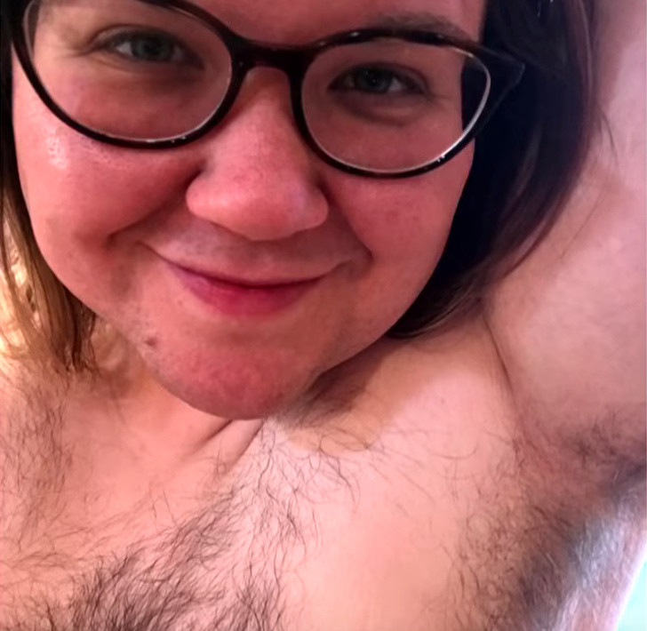 Bat ngo can benh khien nguoi phu nu moc long tua tua-Hinh-2