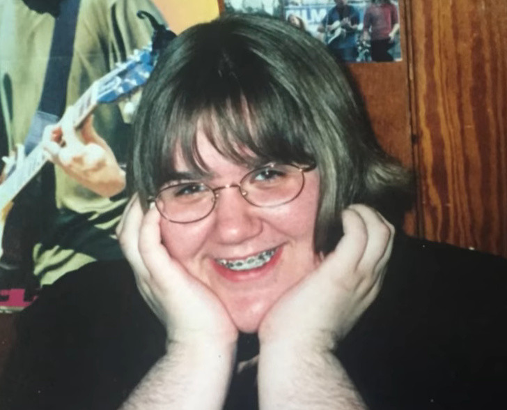 Bat ngo can benh khien nguoi phu nu moc long tua tua