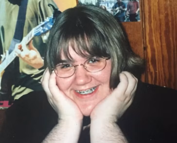 Bat ngo can benh khien nguoi phu nu moc long tua tua