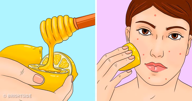 Việc bôi mặt nạ chanh với mật ong hai lần/tuần vừa ngăn mụn trứng cá vừa giảm nếp nhăn, giúp mặt mịn màng hơn. Ảnh: BS.