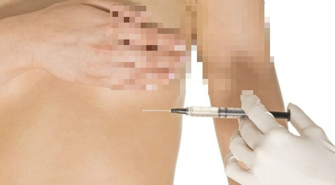 Không ít người đã phải nhận trái đắng vì làm đẹp bằng Filler (Ảnh minh họa).