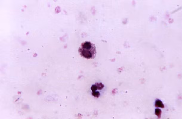 Ngược lại, muỗi bị thu hút ít nhất với những người nhóm máu A.