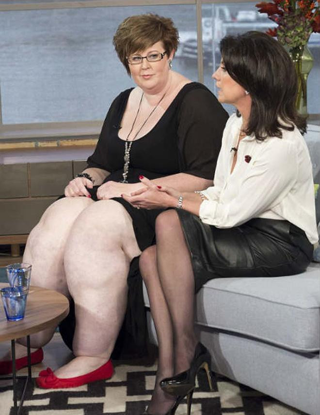 Hoang hon ve ngoai kho tin cua nhung phu nu mac benh la-Hinh-6