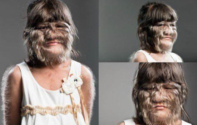 Hoang hon ve ngoai kho tin cua nhung phu nu mac benh la-Hinh-2