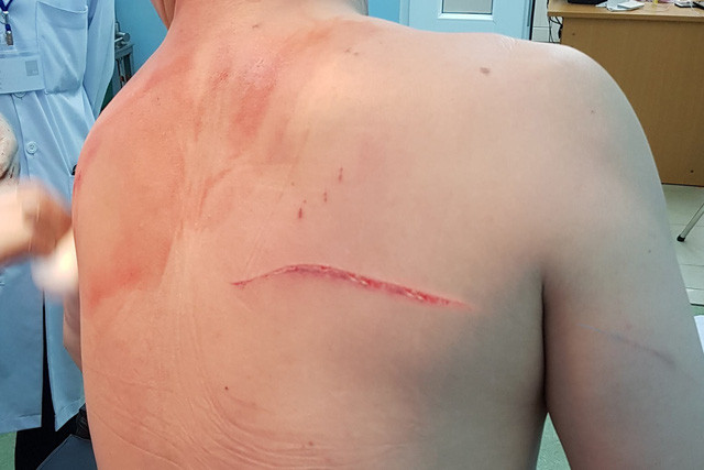 Bác sĩ Chiêm Quốc Thái bị chém ngày 28/3. Ảnh: nguồn Facebook Chiêm Quốc Thái