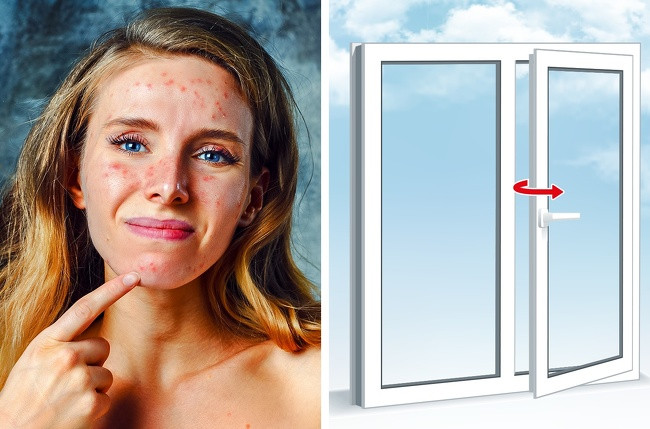 Gần đây, các nhà khoa học đã tìm ra mối tương quan trực tiếp giữa ô nhiễm không khí và lão hóa sớm. Nếu căn hộ hoặc nơi làm việc của bạn quá gần với nguồn ô nhiễm, hãy tránh mở cửa sổ.