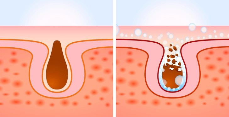 Làm sạch nhiều bước: Phụ nữ Hàn Quốc làm sạch da bằng khá nhiều bước. Đầu tiên là sử dụng dung dịch tẩy trang để loại bỏ tất cả tạp chất trên da. Bước thứ hai là sử dụng chất tẩy rửa như sữa rửa mặt để loại bỏ dư lượng mồ hôi và bụi bẩn.