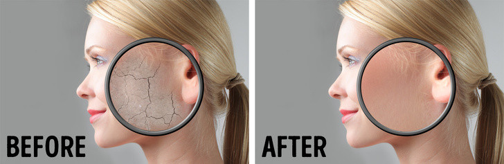 Massage mặt: Đây là nguyên tắc chăm sóc da giúp ngăn ngừa lão hóa bằng cách thúc đẩy lưu thông máu và loại bỏ chất thải. Bạn nên massage dọc theo đường V, ở những vùng trên trán và giữa mắt, vùng quanh miệng để ngăn ngừa nếp nhăn.