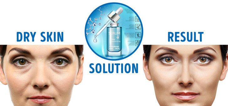 Bổ sung axit Hyaluronic: Axit Hyaluronic có chứa thành phần kết dính độ ẩm tuyệt vời, giúp duy trì độ ẩm và tính đàn hồi cho làn da.