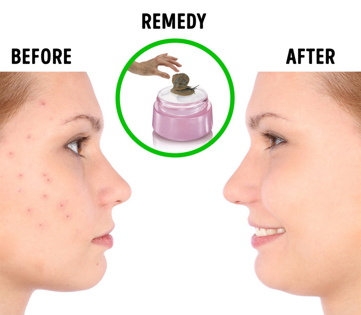 Chất nhầy ốc sên: Công nghiệp mỹ phẩm Hàn Quốc luôn tiên phong trong việc tìm kiếm các thành phần tự nhiên để chăm sóc da. Chất nhầy ốc là một ví dụ điển hình trong việc làm đẹp từ thiên nhiên.