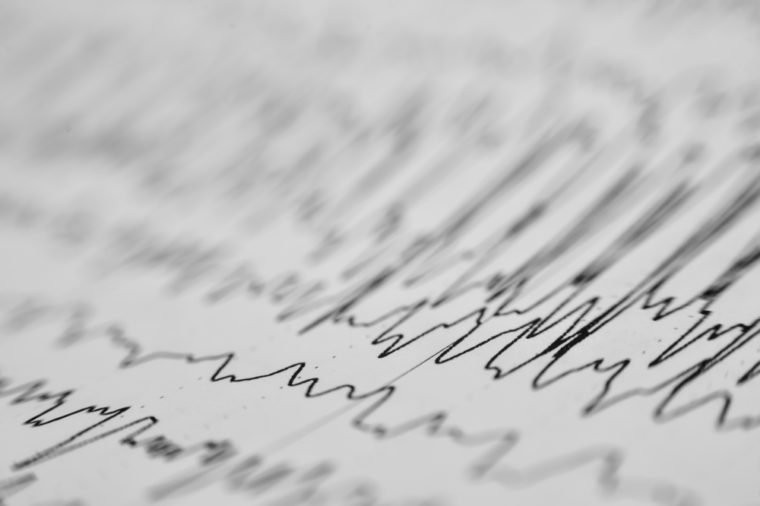 Đột quỵ (tai biến mạch máu não) là tình trạng bệnh lý do tổn thương mạch máu não đột ngột (mạch máu bị tắc hay rò rỉ). Các tế bào não thiếu oxy sẽ bị chết trong vòng vài phút. Đột quỵ gây ra vào khoảng 6,7 triệu ca tử vong trên thế giới mỗi năm, theo WHO.