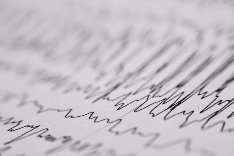 Đột quỵ (tai biến mạch máu não) là tình trạng bệnh lý do tổn thương mạch máu não đột ngột (mạch máu bị tắc hay rò rỉ). Các tế bào não thiếu oxy sẽ bị chết trong vòng vài phút. Đột quỵ gây ra vào khoảng 6,7 triệu ca tử vong trên thế giới mỗi năm, theo WHO.