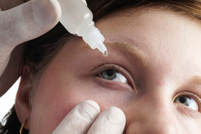 Sử dụng thuốc nhỏ mắt không kê toa: Khi đang bị khô mắt hoặc đỏ mắt, chúng ra thường dùng thuốc nhỏ mắt. Tuy nhiên, nếu bạn sử dụng thuốc nhỏ mắt mà không có sự chỉ định của bác sĩ, nó có thể gây hại nhiều hơn. Các hóa chất được sử dụng để bảo quản thuốc nhỏ mắt có thể gây kích ứng mắt.