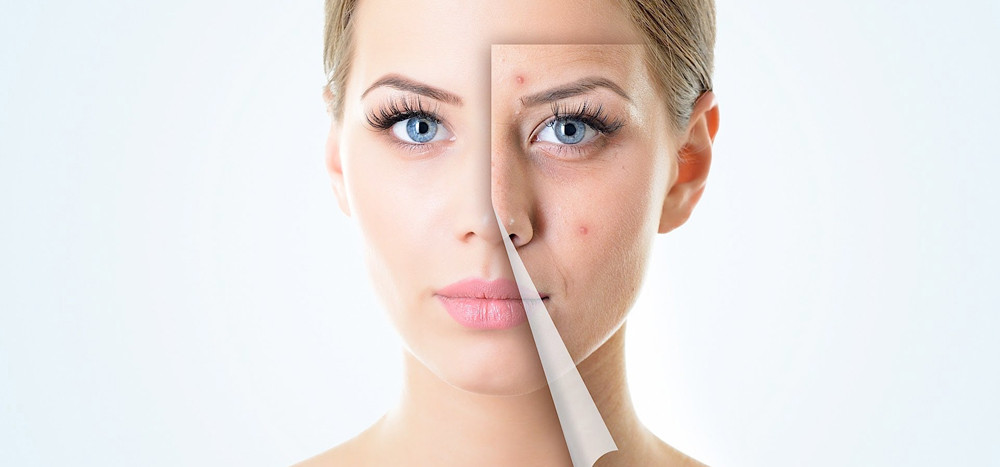 Làm giảm sẹo và đốm nám: Các loại kem ban đêm đơn giản nếu được sử dụng đúng cách và thường xuyên trong một khoảng thời gian dài sẽ có thể làm giảm các đốm nám và mờ sẹo. Ảnh: Internet.