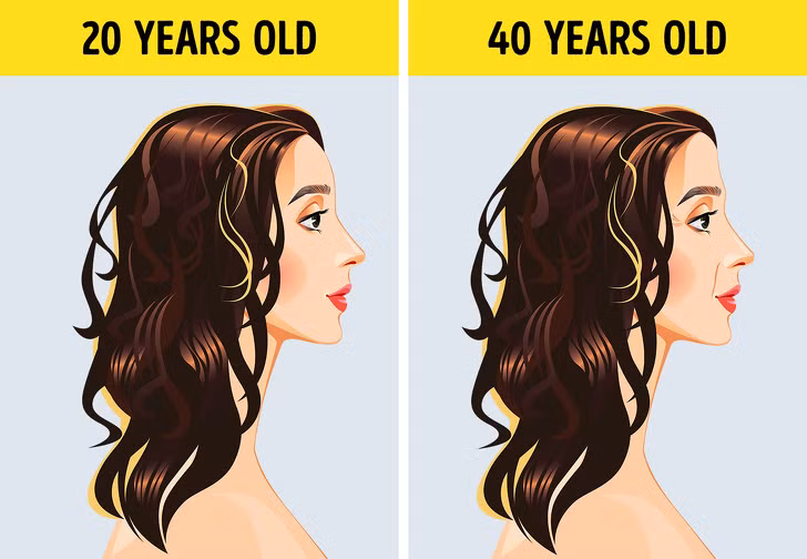 Trán phẳng: Đây là kết quả của sự teo mô mỡ - nó làm cho trán bằng phẳng, trơn tru và không có nếp nhăn.