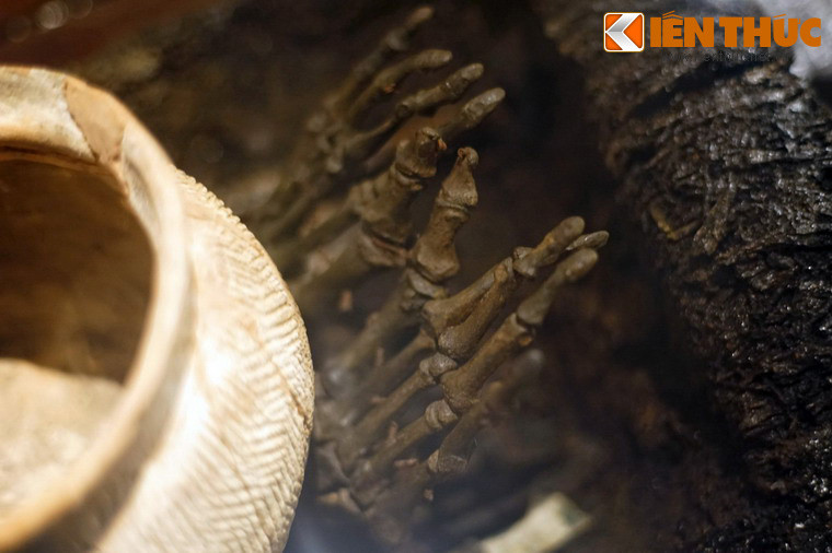 Xương bàn chân của người đã khuất.