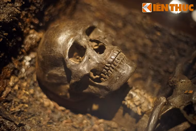 Cận cảnh hộp sọ người quá cố.