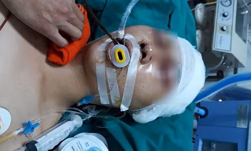 Bat nhom doi tuong danh nam sinh chan thuong so nao truoc cua nha-Hinh-2