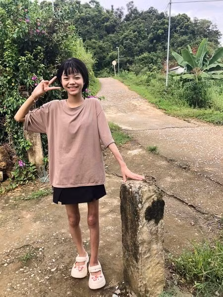 Phep mau giup be 15 tuoi chien thang can benh ung thu xuong