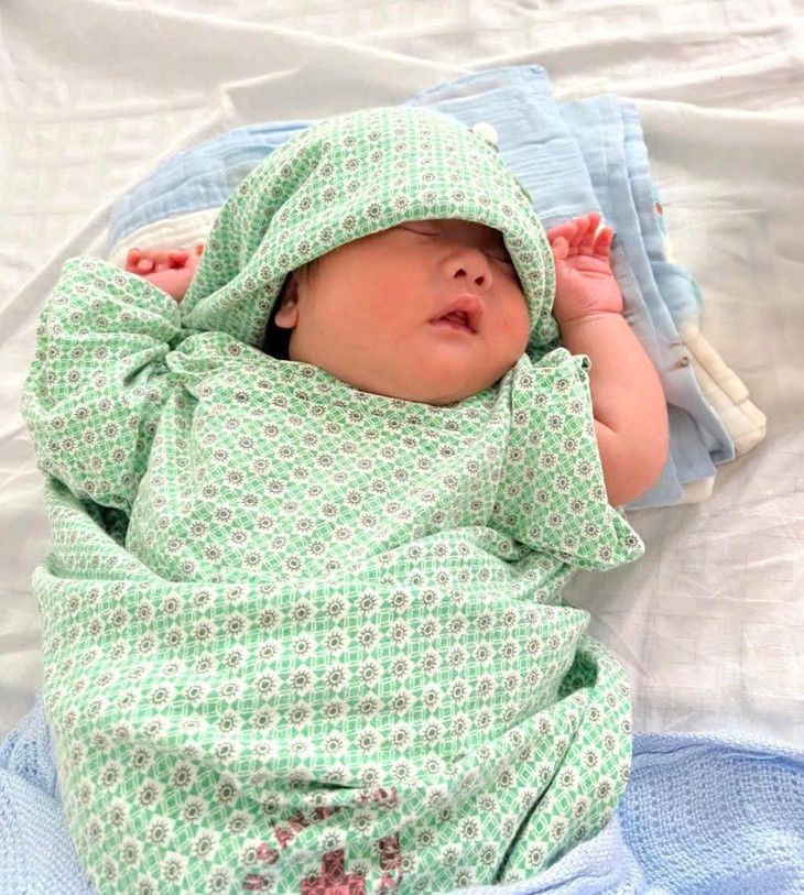 Ky tich 7 tuan giu thai doa sinh non tu tuan 25