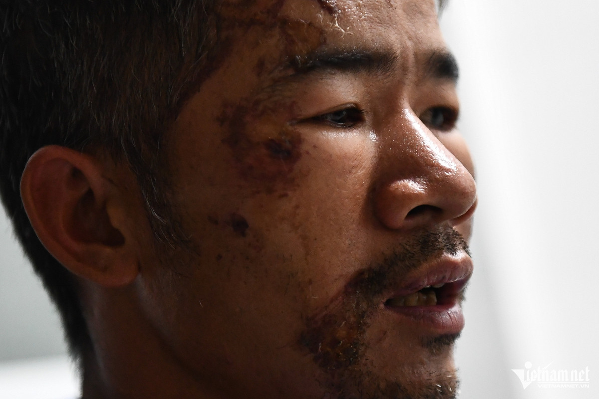 "Tôi lồm cồm bò dậy thì thấy gần đó cũng có một người bèn lội đến cứu, thì ra lại chính là con gái mình. Trong cơn hoảng loạn, hai bố con vừa kêu cứu, vừa dìu nhau bò lên chỗ cao. Khi ấy nước sau lưng vẫn cuồn cuộn tràn về. Đến giờ, tôi vẫn kinh hãi, không thể ngủ nổi", ông Nhớ kể lại.