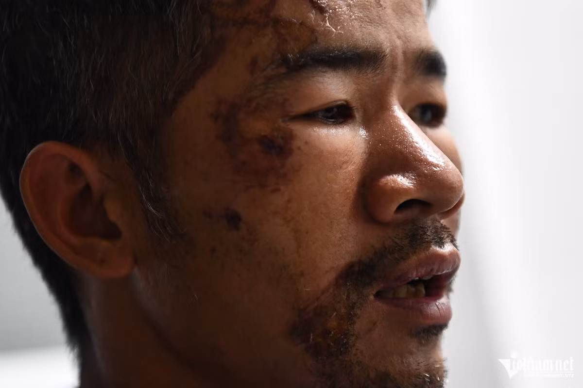 "Tôi lồm cồm bò dậy thì thấy gần đó cũng có một người bèn lội đến cứu, thì ra lại chính là con gái mình. Trong cơn hoảng loạn, hai bố con vừa kêu cứu, vừa dìu nhau bò lên chỗ cao. Khi ấy nước sau lưng vẫn cuồn cuộn tràn về. Đến giờ, tôi vẫn kinh hãi, không thể ngủ nổi", ông Nhớ kể lại.